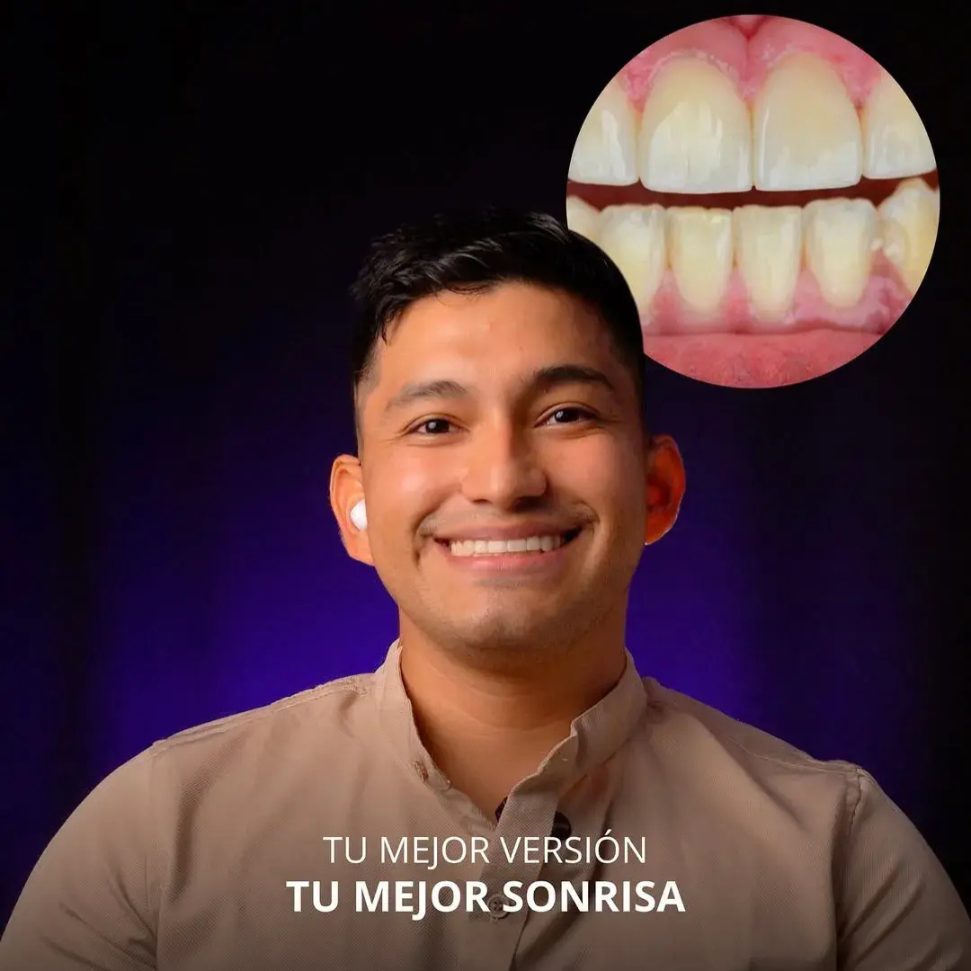 CARRUSEL PAUTA LASSO (1)